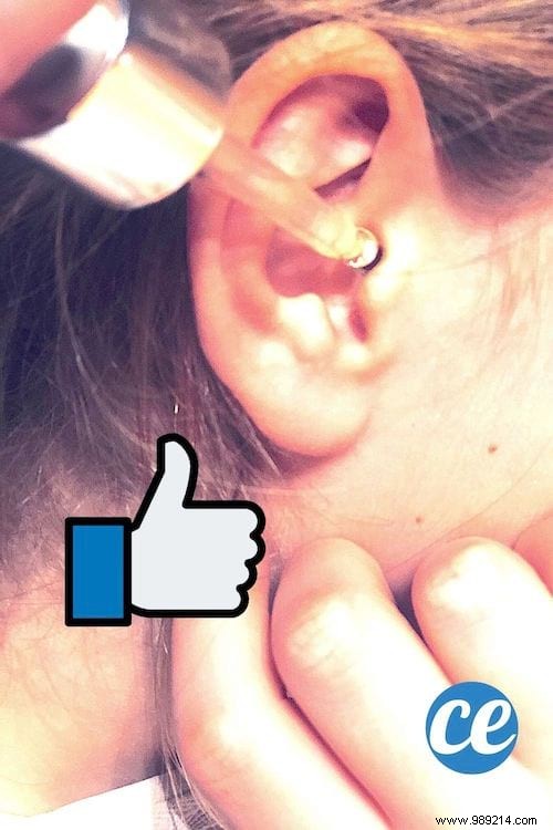 How to Safely Remove Earwax Blockage at Home: A Proven Natural Baking Soda Remedy