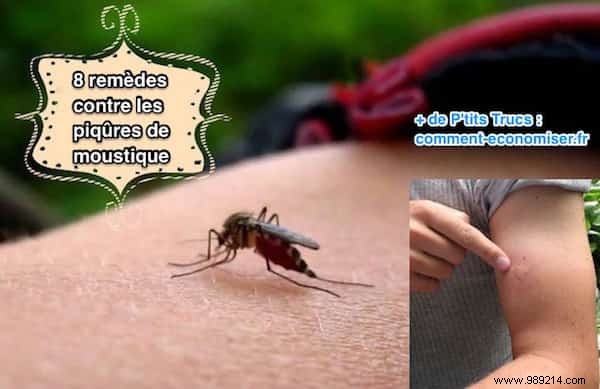 8 Proven Home Remedies for Fast Relief from Itchy Mosquito Bites
