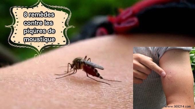 8 Proven Home Remedies for Fast Relief from Itchy Mosquito Bites