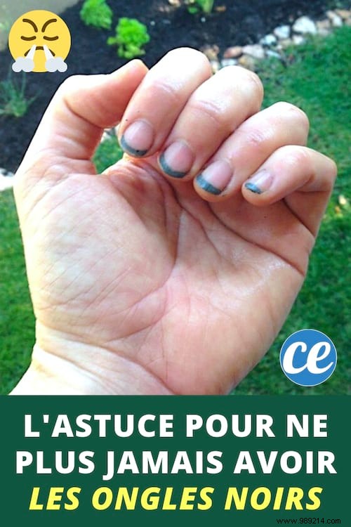 Gardener s Essential Trick: Prevent Black Nails from Dirt Forever