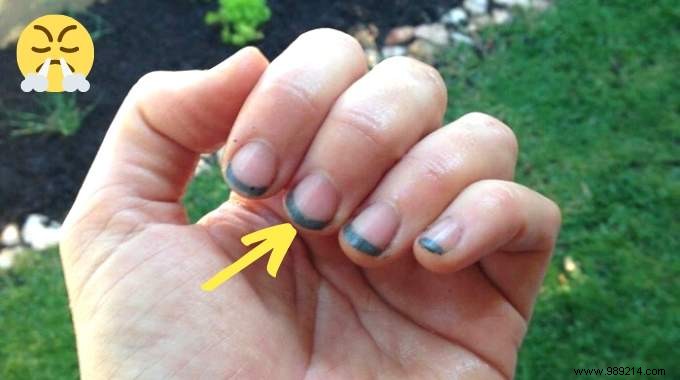 Gardener s Essential Trick: Prevent Black Nails from Dirt Forever