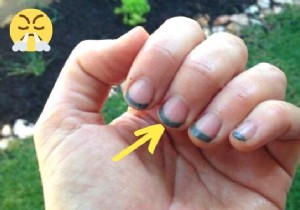 Gardener s Essential Trick: Prevent Black Nails from Dirt Forever