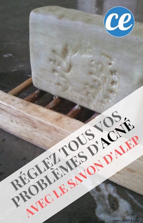 How Authentic Aleppo Soap Clears Acne and Heals Skin: Proven Tips from Experience