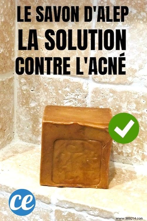 How Authentic Aleppo Soap Clears Acne and Heals Skin: Proven Tips from Experience