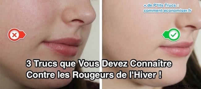 3 Proven Natural Tips to Soothe Winter Skin Redness on Face, Baby s Skin, and Hands