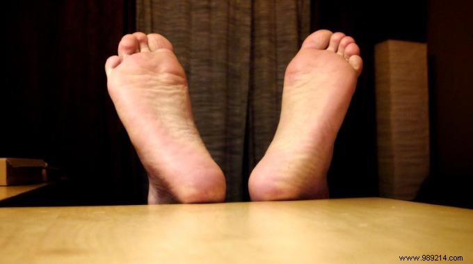 Soothe Painful Foot Calluses Naturally with Baking Soda Paste