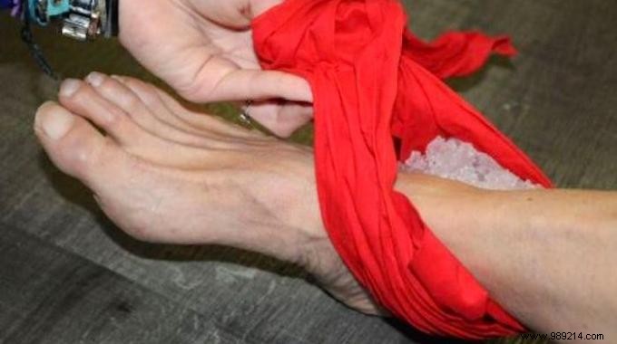 DIY Leak-Proof Ice Pack for Sprains: No Messy Melts