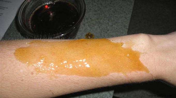 Easy DIY Honey-Lemon Wax for Smooth Hair Removal at Home