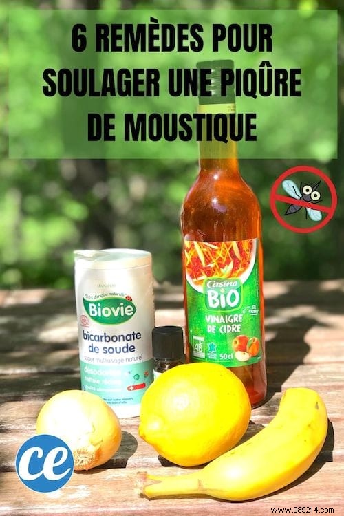 6 Proven Natural Remedies for Mosquito Bites: Fast, Effective Relief at Home