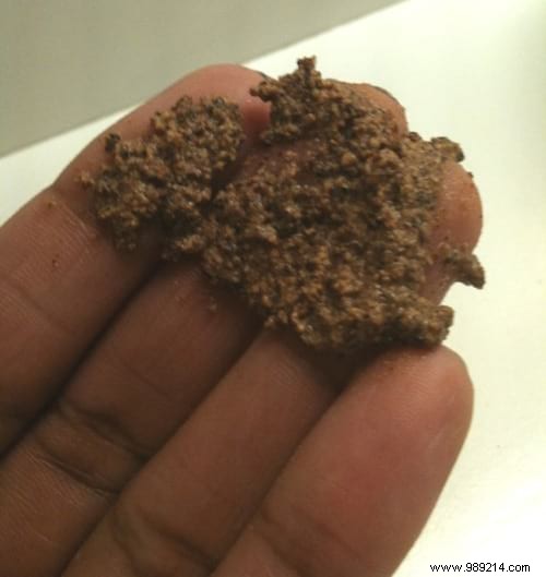 Quickly Banish Pimples with Nutmeg: A Simple, Effective Kitchen Remedy