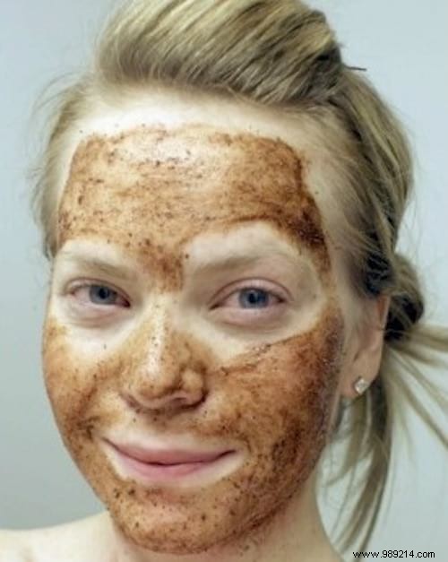 Quickly Banish Pimples with Nutmeg: A Simple, Effective Kitchen Remedy