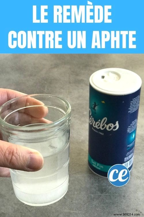 Fast Mouth Ulcer Relief: Proven Salt Water Rinse Remedy