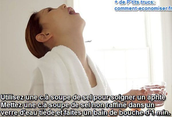 Fast Mouth Ulcer Relief: Proven Salt Water Rinse Remedy