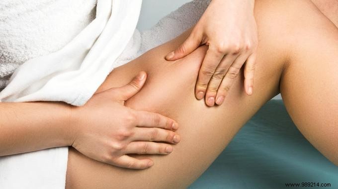 11 Proven Natural Remedies to Effectively Reduce Cellulite