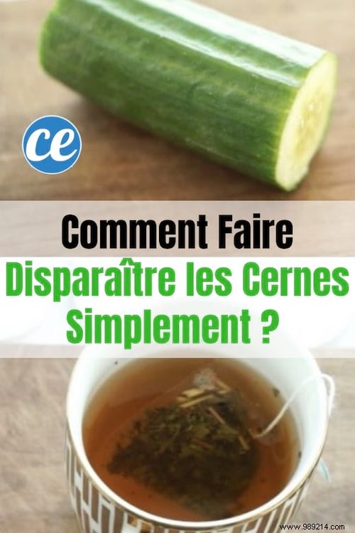 Banish Dark Circles Naturally: Proven Tea Bags and Cucumber Remedy