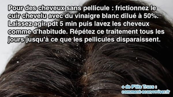 Effective White Vinegar Remedy: Banish Dandruff Naturally