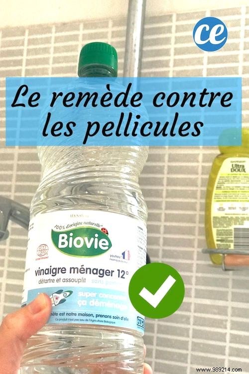 Effective White Vinegar Remedy: Banish Dandruff Naturally