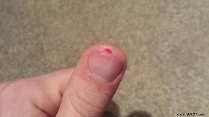 How to Secure a Bandage on Your Fingertip for Long-Lasting Protection