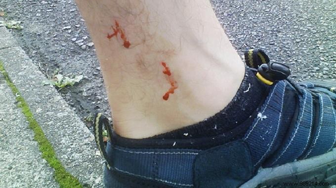 Heal Minor Cuts and Scrapes Naturally with Garlic: A Trusted Remedy