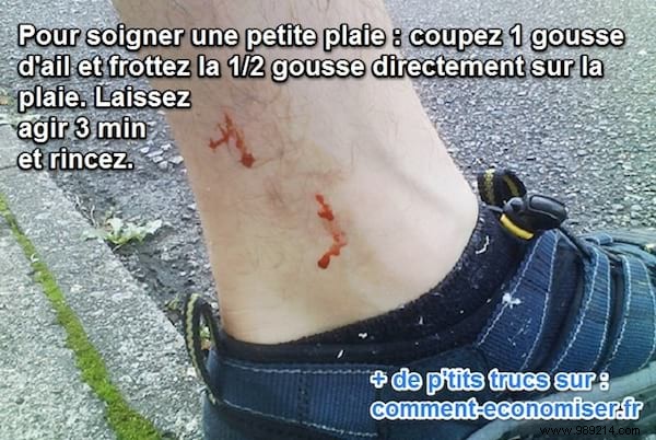 Heal Minor Cuts and Scrapes Naturally with Garlic: A Trusted Remedy