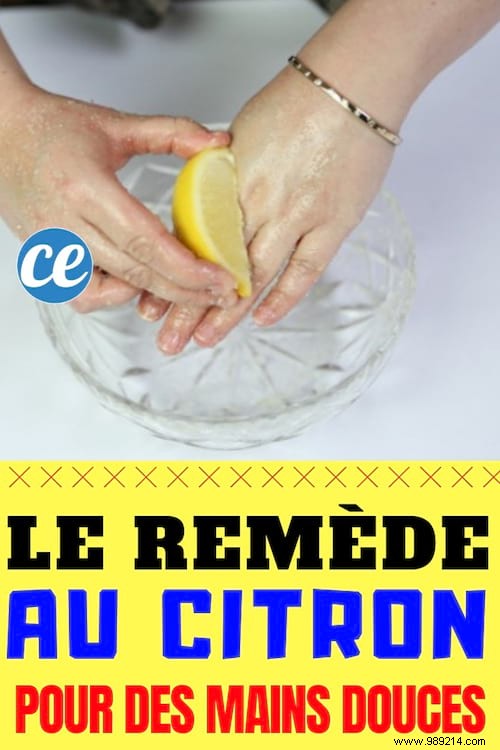 Achieve Silky Soft Hands with This Proven Lemon Peel Remedy