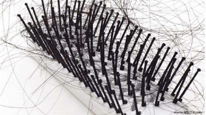 Stop Hair Loss Naturally: Garlic and Olive Oil Treatment That Works