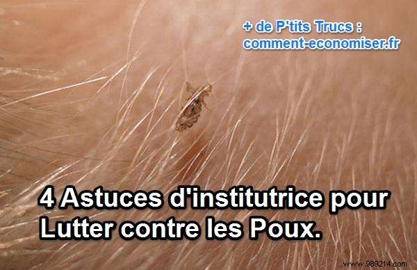 4 Proven Teacher Tips to Eliminate Head Lice Naturally