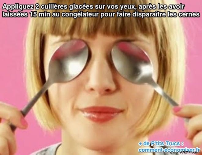 Erase Dark Circles Naturally: The Simple Spoon Trick That Works