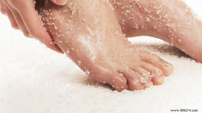 Effective Natural Wart Removal: Time-Tested Salt Remedy