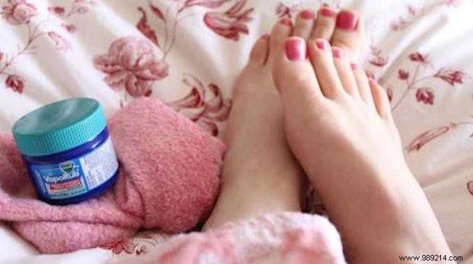 Soothe a Persistent Cough in Minutes: The Vicks VapoRub Foot Remedy
