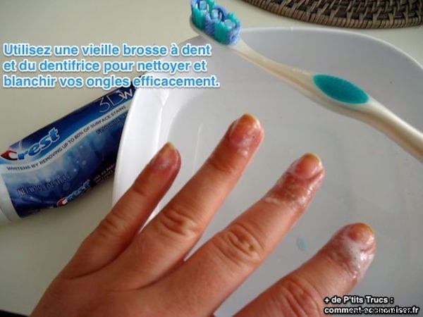 Whiten Yellowed Nails in Under 1 Minute: The Proven Toothpaste Method