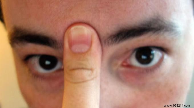 Clear Clogged Sinuses Naturally in 20 Seconds: Simple Tongue and Finger Technique