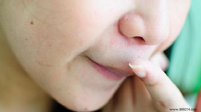 Soothe an Irritated Nose with This Proven Home Remedy