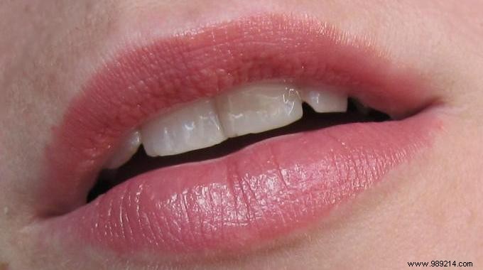 Grandma s Time-Tested Natural Lip Balm for Chapped Lips: Quick, Effective Relief