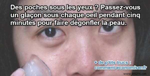 Quick Natural Fix: Reduce Under-Eye Bags with Ice Cubes