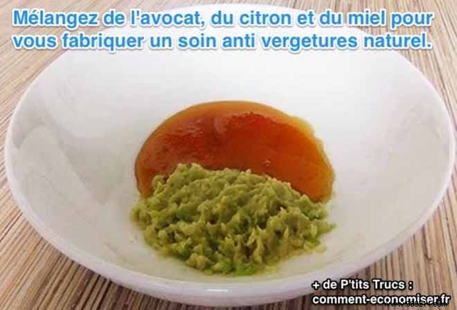 Natural Avocado Balm: Proven Home Remedy to Fade Stretch Marks Effectively