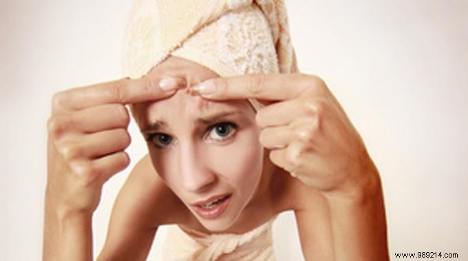 11 Proven Natural Remedies to Effectively Combat Acne