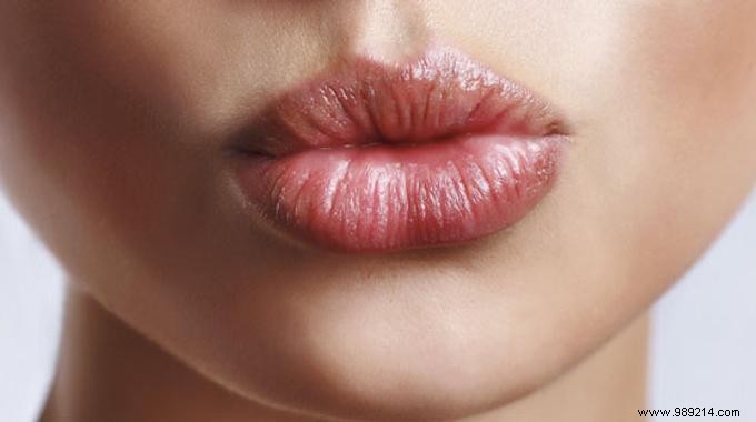 10 Proven Natural Remedies for Chapped Lips: Soothe, Hydrate, and Heal Naturally