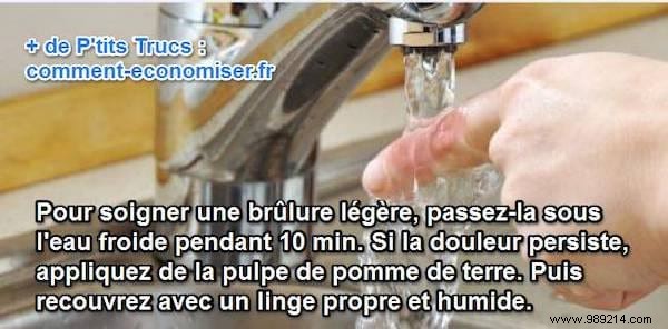 Quick First Aid for Minor Burns: Cold Water and Potato Remedy