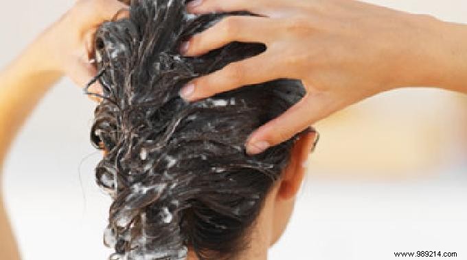 11 Proven Natural Remedies to Banish Dandruff for Good
