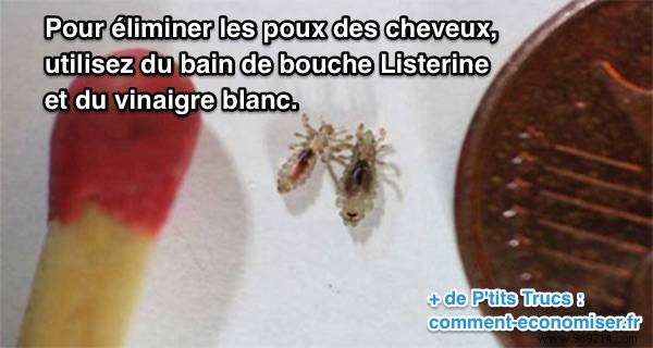 Eliminate Head Lice Naturally: Proven Homemade Remedy with Vinegar and Mouthwash