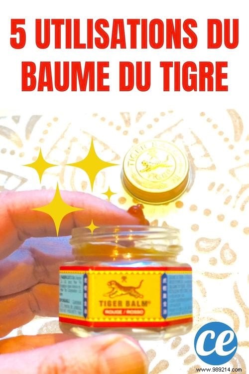 5 Proven Tiger Balm Uses: Relieve Pain, Clear Congestion and More