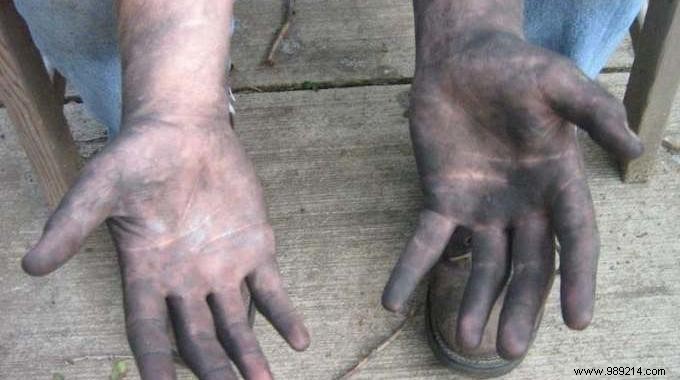 Simple Trick to Remove Grease from Hands After Mechanics Work