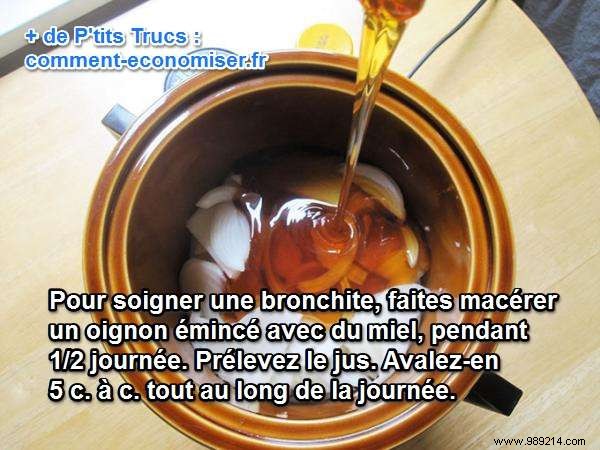 Grandmother s Proven Remedy: Honey-Onion Syrup for Natural Bronchitis Relief