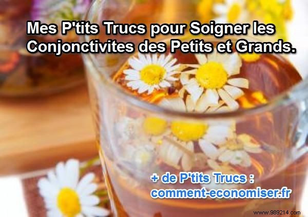 Natural Remedies for Conjunctivitis: Safe, Effective Tips for Adults and Children