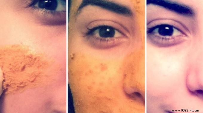 Natural Turmeric Face Mask: A Science-Backed Recipe to Fight Wrinkles