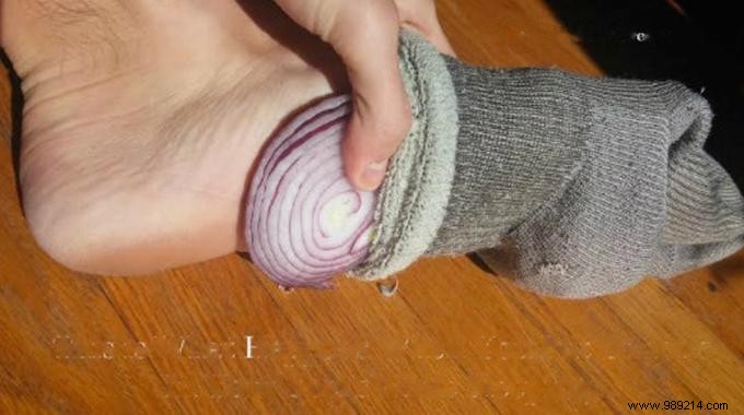 The Time-Tested Onion-in-Socks Remedy: Natural Relief for Colds and Flu