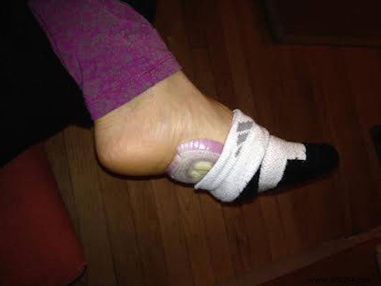 The Time-Tested Onion-in-Socks Remedy: Natural Relief for Colds and Flu