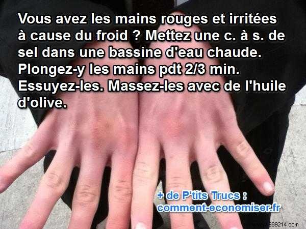 Soothe Red, Irritated Hands from Cold Weather: My Grandmother s Proven Natural Remedy