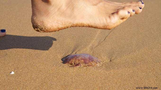 Quick Beachside Remedy for Jellyfish Stings: Proven Steps for Fast Relief